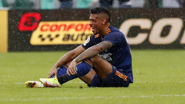 El delantero del Real Madrid se someterá a cirugía para una fractura de hueso nasal en el césped